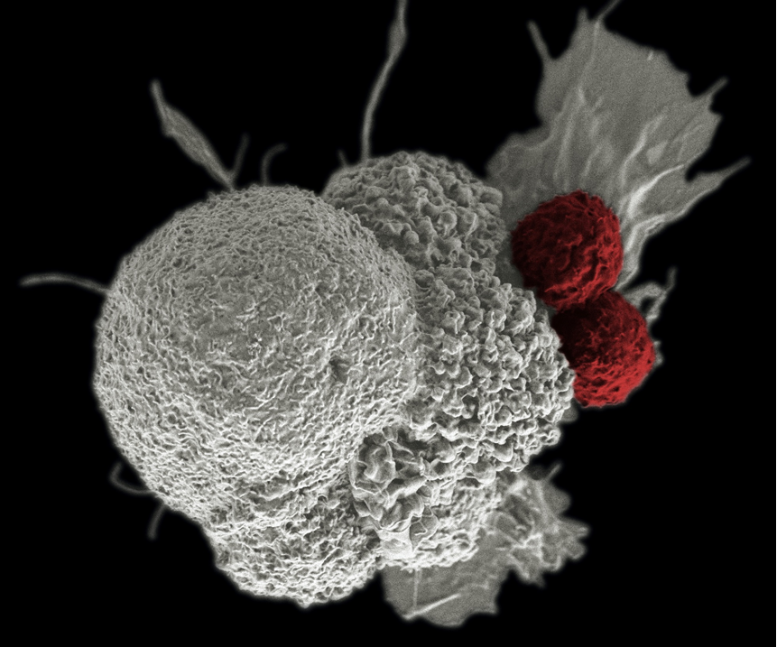 False-color micrograph from a scanning electron microscope showing a cancer cell being attacked by smaller immune T cells. Image credit: National Cancer Institute