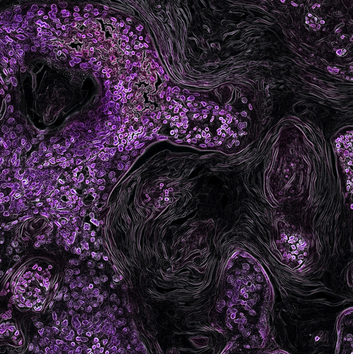 False-color cross-sectional image of Kras-Driven Lung Cancer cells. Image credit: Eric Snyder/National Cancer Institute