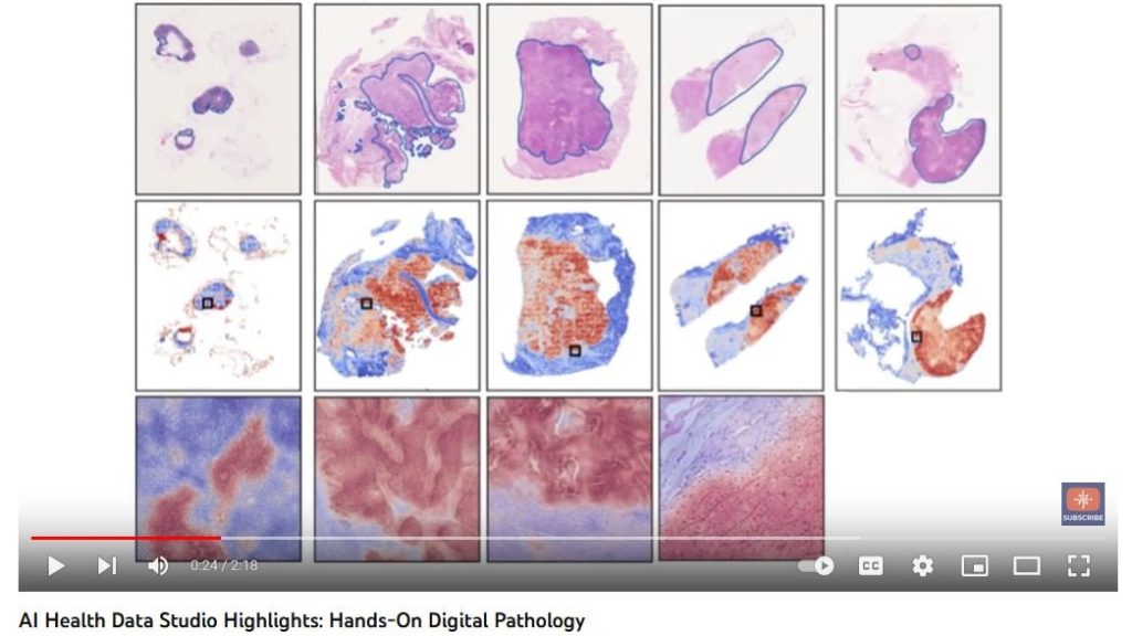 Screencapture from the video showing pathology images